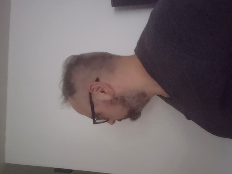 Profilo troppo marcato